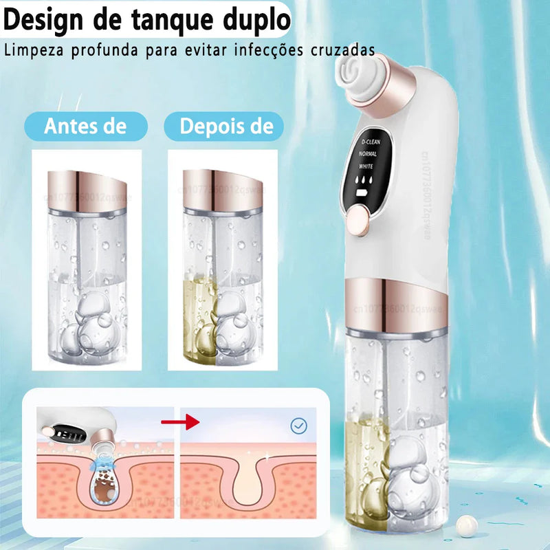 Removedor de Cravos com Sucção e Água – Limpeza Profunda, Antiacne, USB Recarregável com Função Microbolha