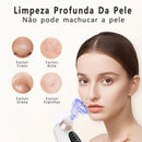 Removedor de Cravos com Sucção e Água – Limpeza Profunda, Antiacne, USB Recarregável com Função Microbolha
