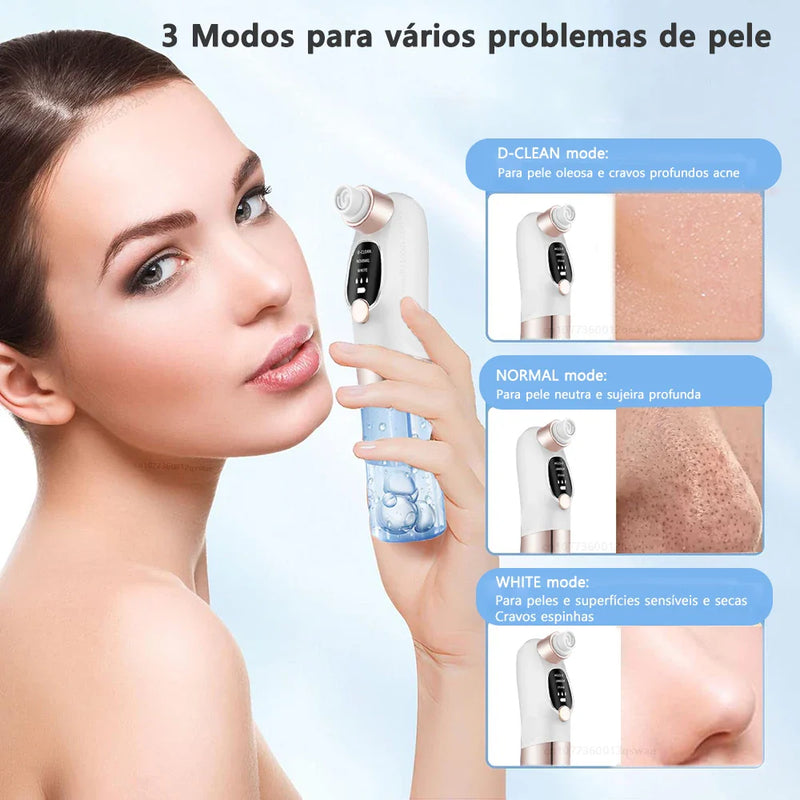 Removedor de Cravos com Sucção e Água – Limpeza Profunda, Antiacne, USB Recarregável com Função Microbolha